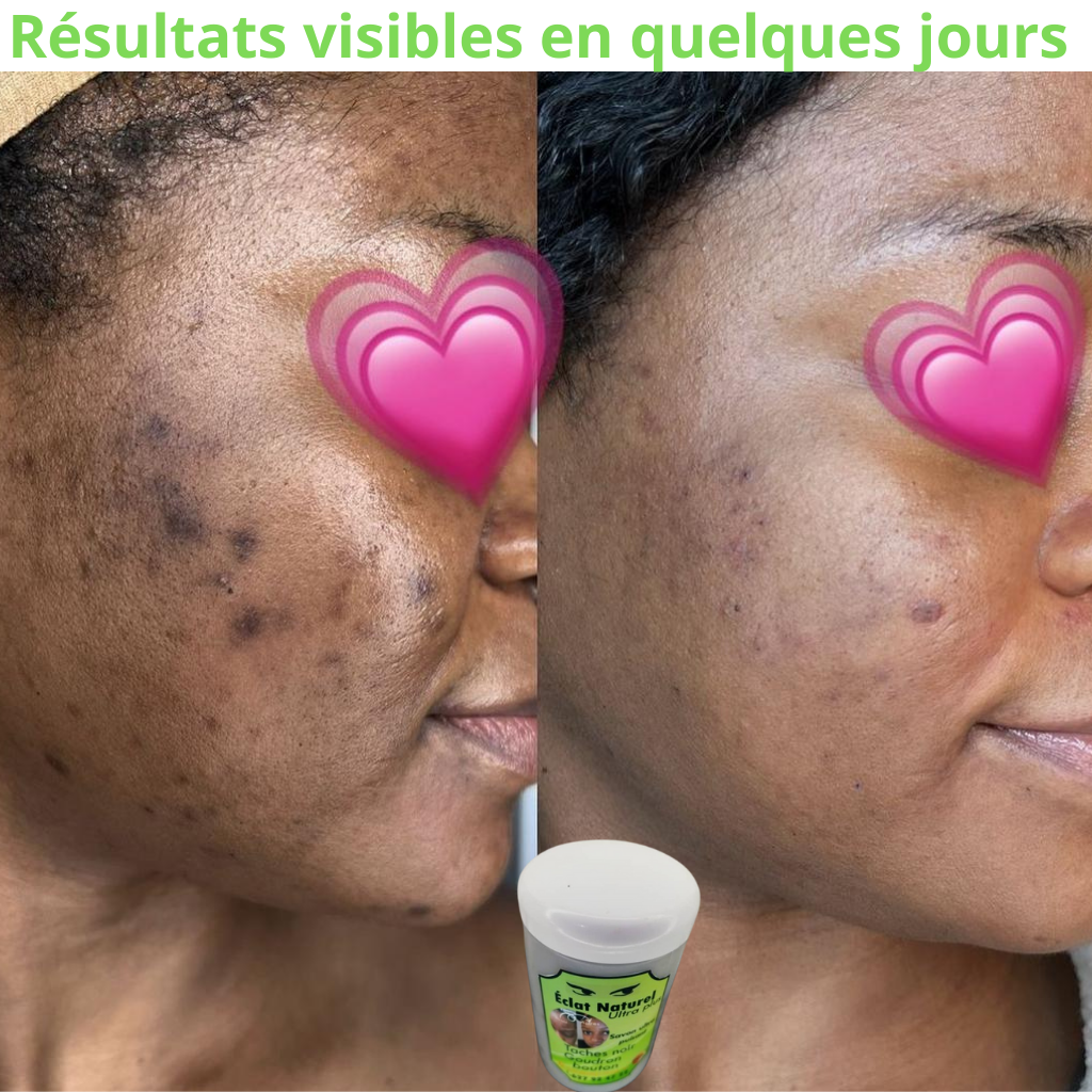 SAVON DE VISAGE ECLAT NATURELS : zéro bouton, zéro tâche, 100% éclat pour homme et femme