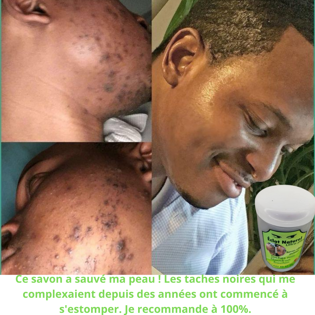 SAVON DE VISAGE ECLAT NATURELS : zéro bouton, zéro tâche, 100% éclat pour homme et femme