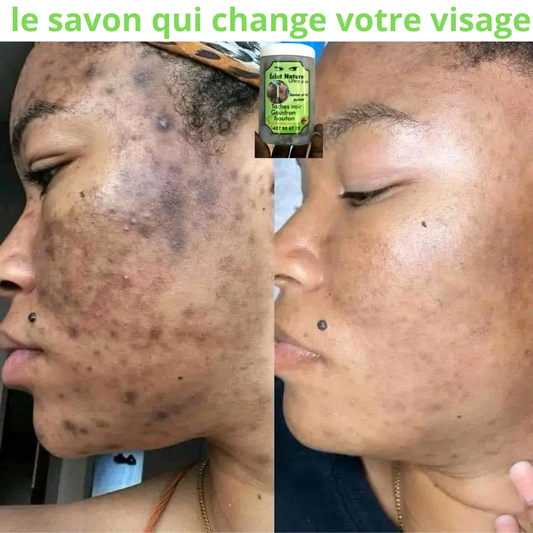 SAVON DE VISAGE ECLAT NATURELS : zéro bouton, zéro tâche, 100% éclat  pour homme et femme